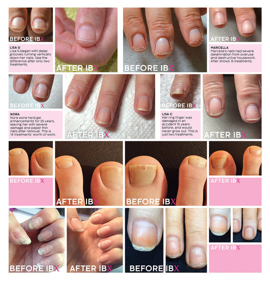 IBX Nail Treatments x 4