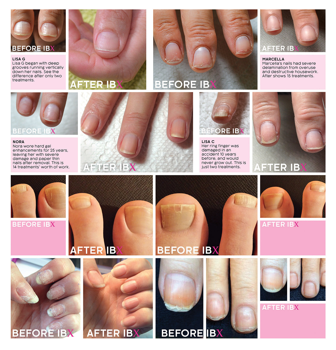 IBX Nail Treatments